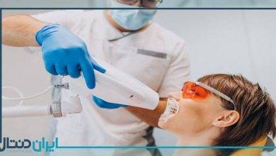 بهترین دکتر بلیچینگ در بوشهر