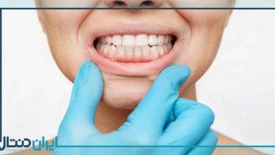 بهترین دکتر لثه در همدان