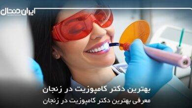 بهترین دکتر کامپوزیت در زنجان