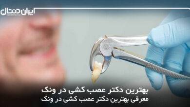 بهترین دکتر عصب کشی در ونک