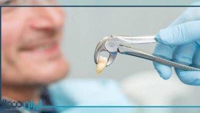 حکم شرعی کشیدن دندان در ماه رمضان چیست؟