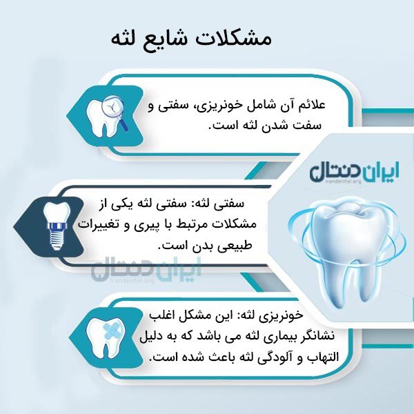 بیماری های لثه و راه های درمان آن