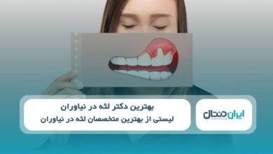 بهترین دکتر لثه در نیاوران