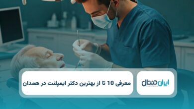 بهترین دکتر ایمپلنت در همدان