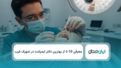بهترین دکتر ایمپلنت در شهرک غرب