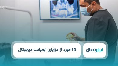 10 مورد از مزایای ایمپلنت دیجیتال
