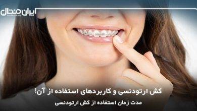 Orthodontic braces