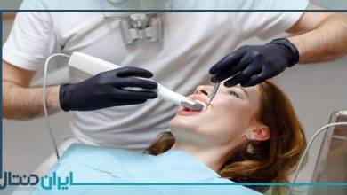 بهترین دندانپزشک زیبایی و ترمیمی در سنندج