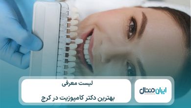معرفی 10 تا از بهترین دکتر کامپوزیت در کرج⚡【سال1405】💙