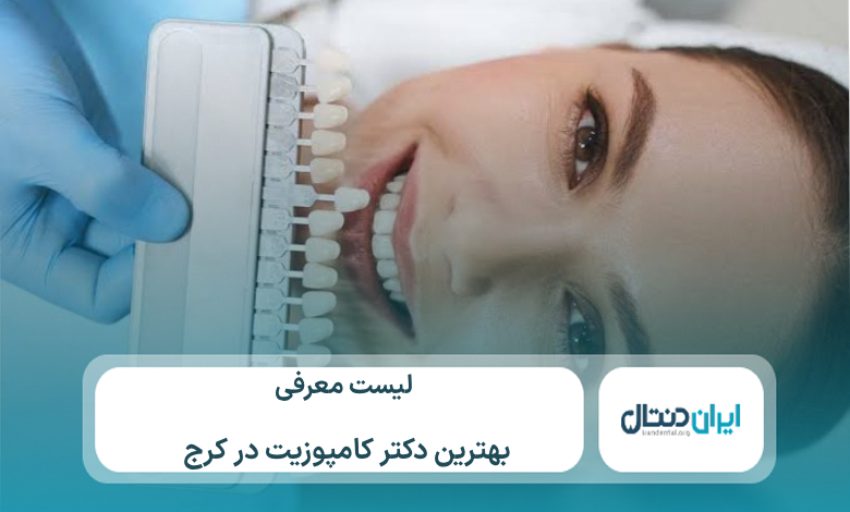 معرفی 10 تا از بهترین دکتر کامپوزیت در کرج⚡【سال1405】💙