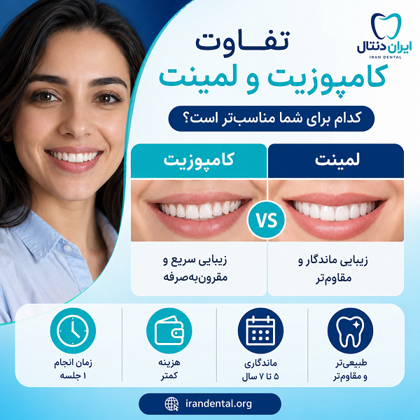 تفااوت لمینت و کامپوزیت چیست؟ کدام برای شما مناسب تر است؟