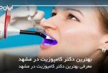 بهترین دکتر کامپوزیت در مشهد