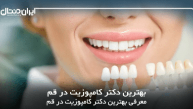 بهترین دکتر کامپوزیت در قم