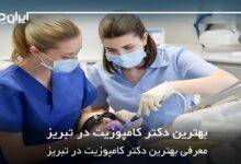 بهترین دکتر کامپوزیت در تبریز