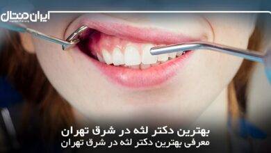 بهترین دکتر لثه در شرق تهران