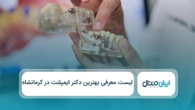 بهترین دکتر ایمپلنت در کرمانشاه