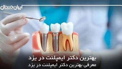 بهترین دکتر ایمپلنت در یزد