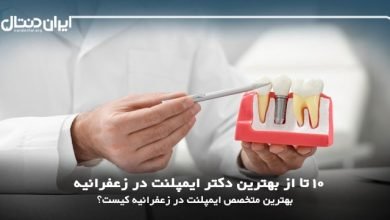 بهترین دکتر ایمپلنت در زعفرانیه