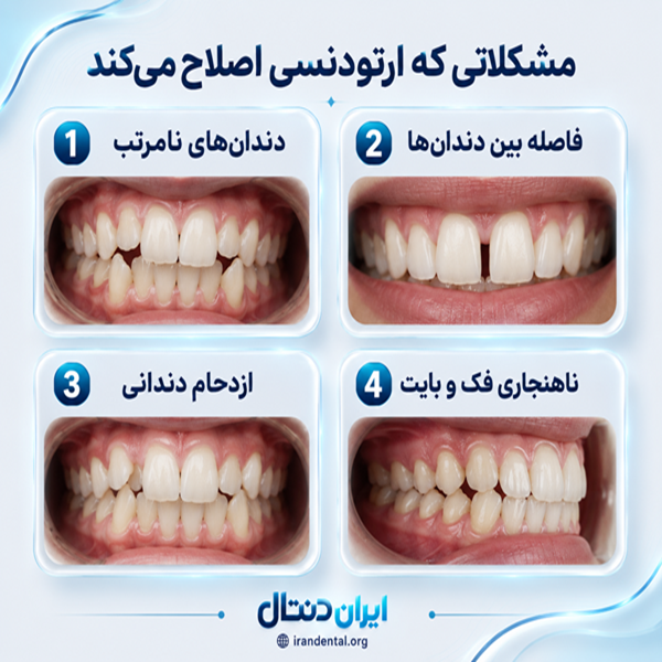چه افرادی مناسب ارتودنسی هستند