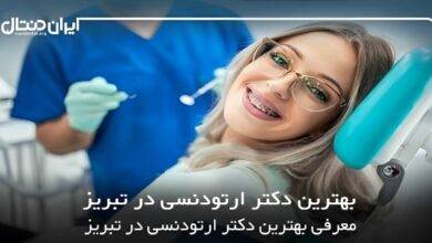 بهترین دکتر ارتودنسی در تبریز