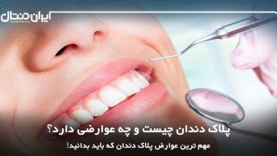 پلاک دندان چیست و چه عوارضی دارد؟