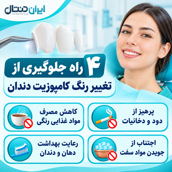 4 راه جلوگیری از تغییر رنگ کامپوزیت دندان