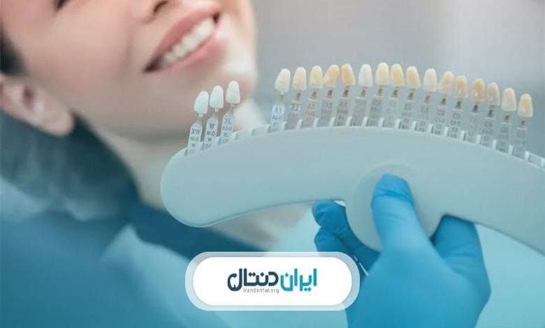 تفاوت کامپوزیت و آمالگام چیست؟