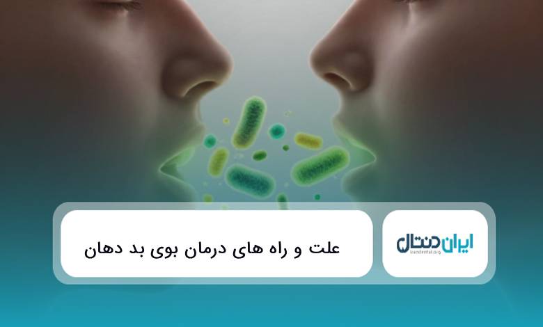 علت و راه های درمان بوی بد دهان { اپدیت سال1405}✅