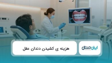 هزینه ی کشیدن دندان عقل {سال1405}✅