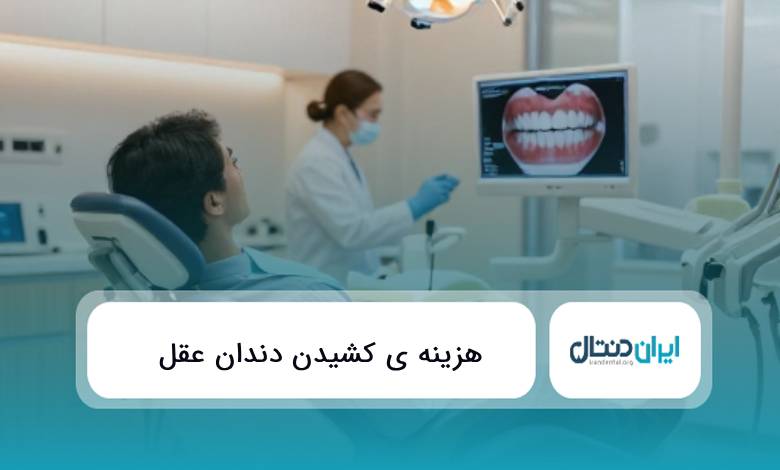هزینه ی کشیدن دندان عقل {سال1405}✅