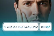 درمان سریع ورم صورت در اثر دندان درد