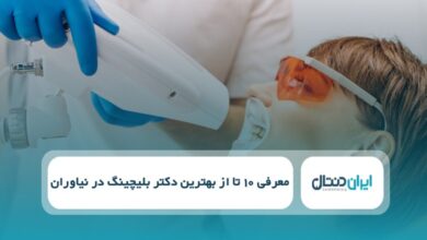 بهترین دکتر بلیچینگ در نیاوران