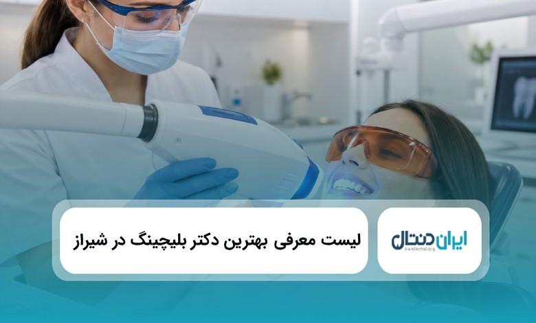 بهترین دکتر بلیچینگ در شیراز