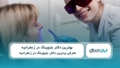 بهترین دکتر بلیچینگ در زعفرانیه