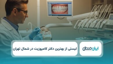 بهترین دکتر کامپوزیت در شمال تهران