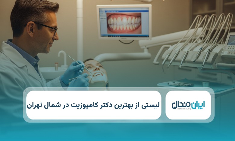 بهترین دکتر کامپوزیت در شمال تهران