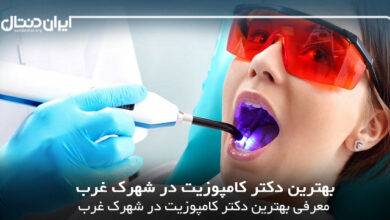 بهترین دکتر کامپوزیت در شهرک غرب