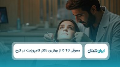 بهترین دکتر کامپوزیت در کرج