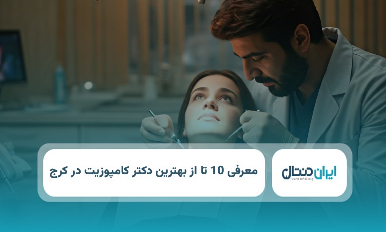 بهترین دکتر کامپوزیت در کرج