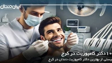 بهترین دکتر کامپوزیت در کرج