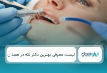 بهترین دکتر لثه در همدان