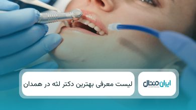 بهترین دکتر لثه در همدان
