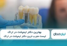 10 تا از بهترین دکتر ایمپلنت در اراک