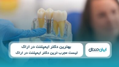 10 تا از بهترین دکتر ایمپلنت در اراک