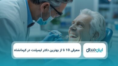 بهترین دکتر ایمپلنت در کرمانشاه