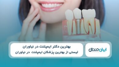 بهترین دکتر ایمپلنت در نیاوران