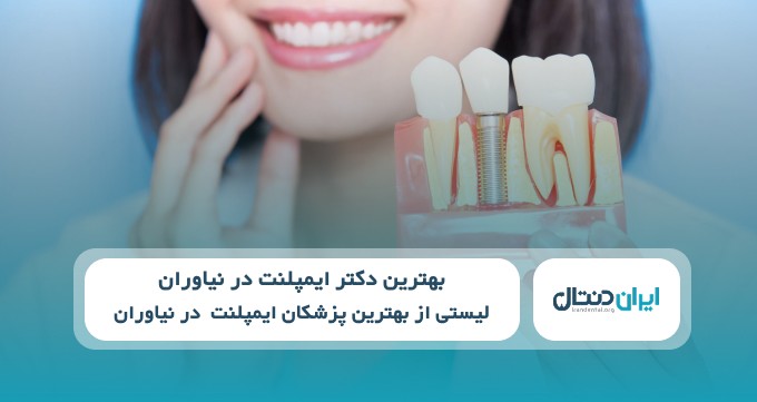 بهترین دکتر ایمپلنت در نیاوران