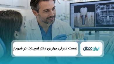 بهترین دکتر ایمپلنت در شهریار