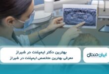 بهترین دکتر ایمپلنت در شیراز
