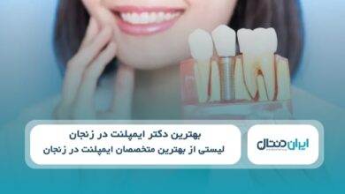 بهترین دکتر ایمپلنت در زنجان